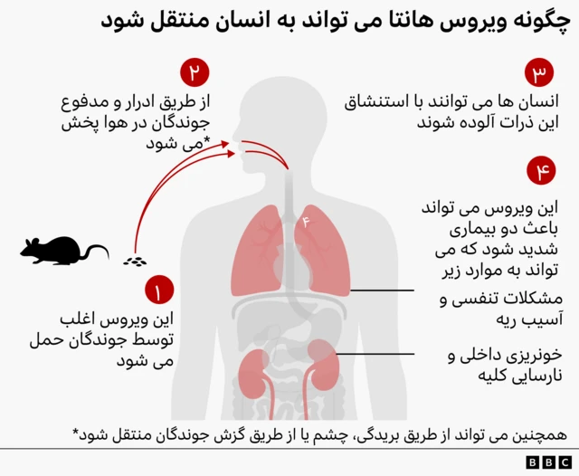 گرافیک ویروس هانتا