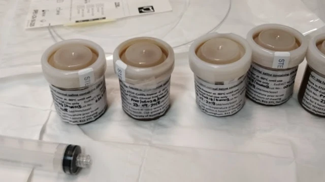 ፊክል ማይክሮባዮታ ትራንስፕላንት