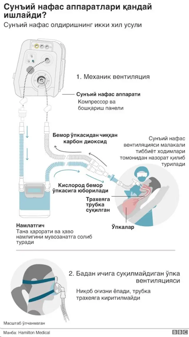 Sun'iy nafas apparati