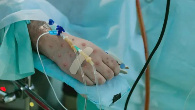 Азыркы тапта ооругандардын саны эле он сегиз миңден ашып кетти