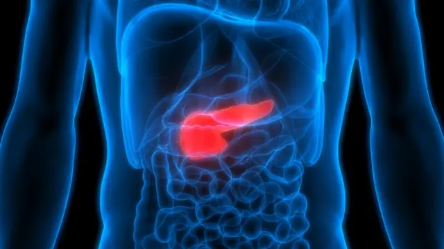 பேலியோ உணவுமுறையால் நீரிழிவு நோய் ஏற்படுமா?