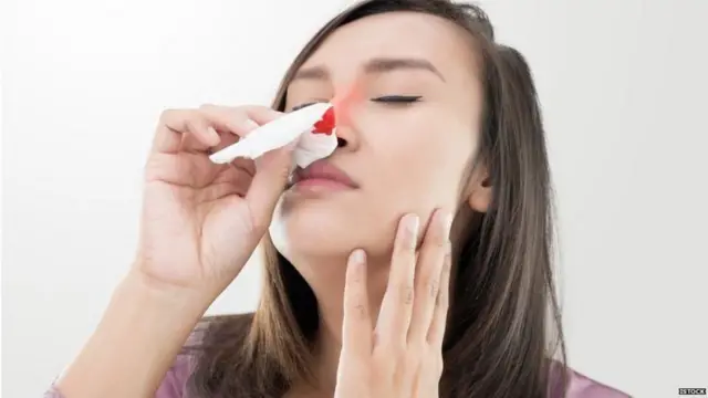 હિમોફિલિયા