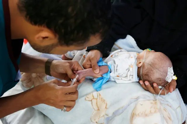 Ачкалыктан эң жабыркаган регион болуп Африка эсептелет: континентте ар бир бешинчи адам ачкачылыктан кыйналууда