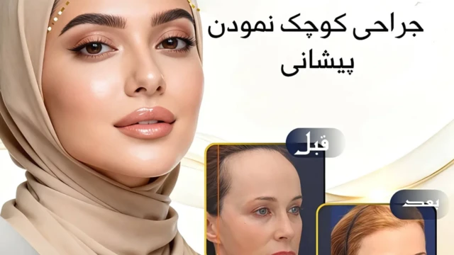پوستر تبلیغاتی یک کلینیک‌ زیبایی در انستاگرام که از تصویرهای هوش مصنوعی استفاده کرده است. 