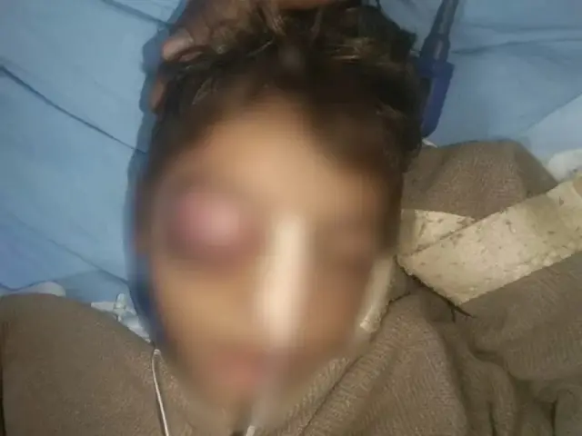 بچے کے کان اور آنکھ پر چوٹ آئی ہے