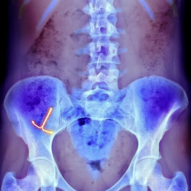 உடல்நலம்