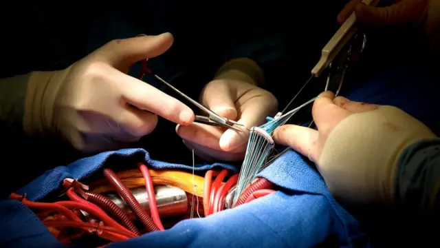 Заплатку любой формы и размера распечатают на 3D-принтере и пришьют прямо к сердцу