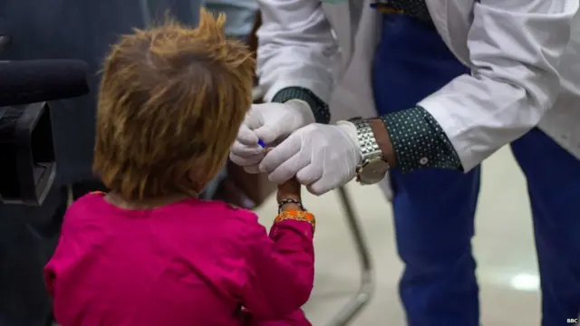 ਏਡਜ਼, ਐਚਆਈਵੀ