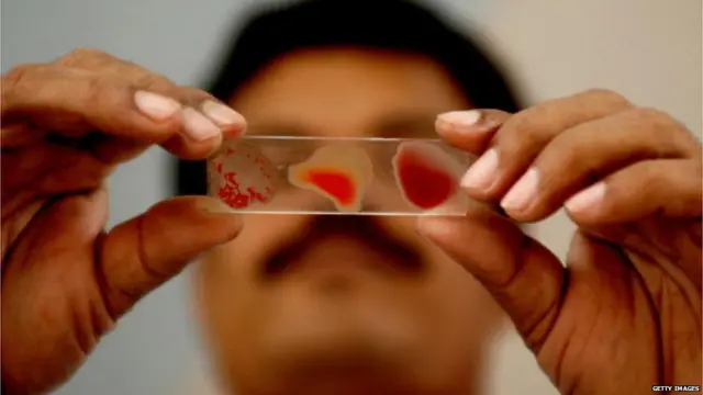 बॉम्बे ब्लड ग्रुप, रक़्तदान