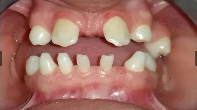 Eze ịkọ mmadụ n'ọnụ