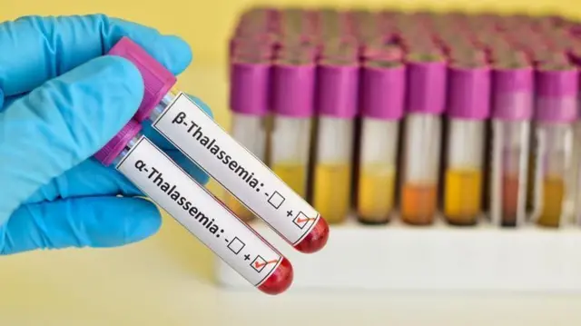 తలసేమియా