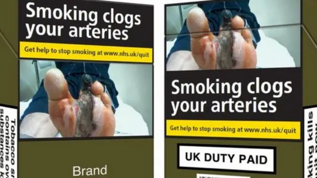 ব্রিটেনে এখন সিগারেটের প্যাকেটে ধূমপানজনিত রোগের ছবি থাকে