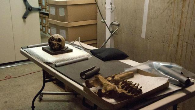 Кости, выложенные для процедуры рентгенографии в Музее Лондона