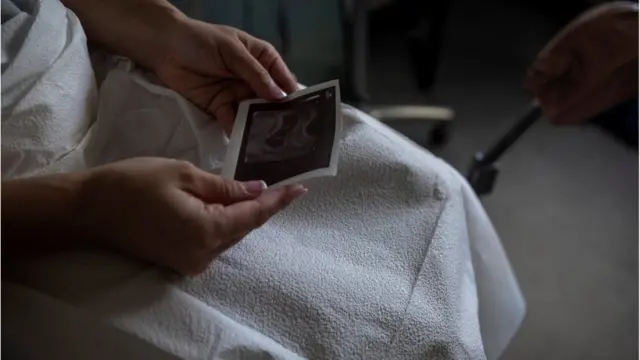 Žena gleda sliku sa ultrazvuka