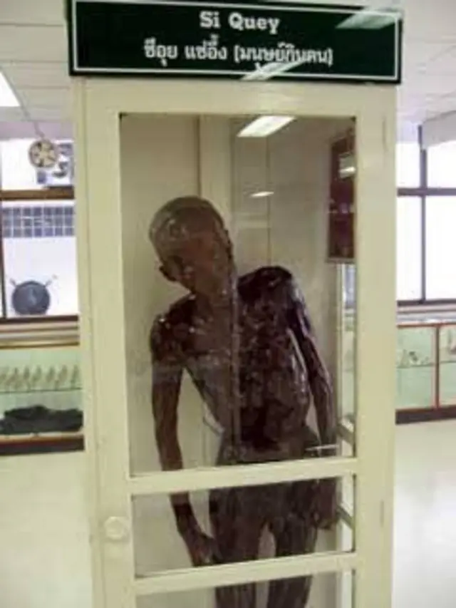 ร่างซีอุย ในพิพิธภัณฑ์ศิริราช