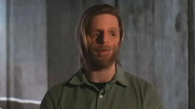 அரிய குறைபாட்டுடன் பிறந்த மனிதர்