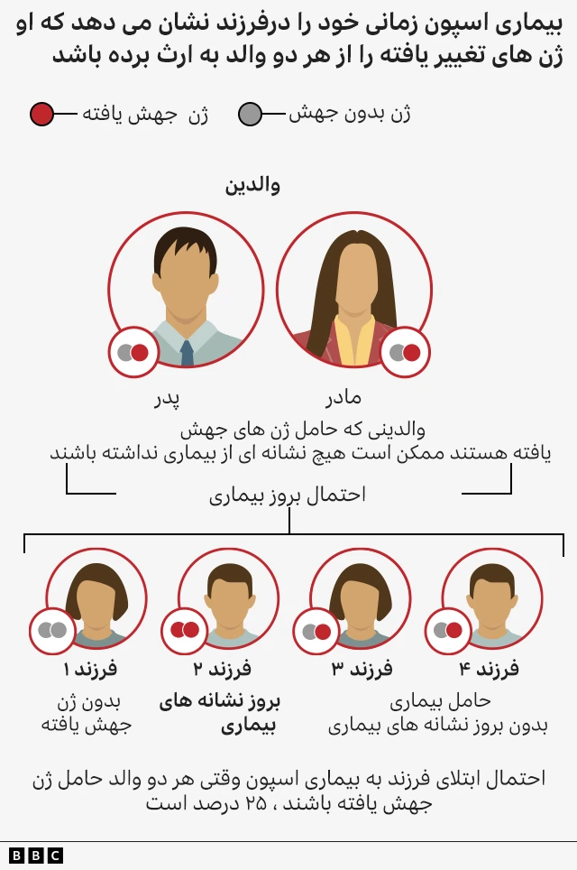 بیماری اسپون چه روندی در بیماران دارد؟