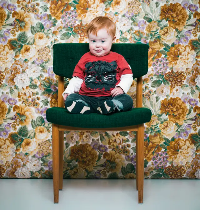 Jakob, un niño con síndrome de Down.