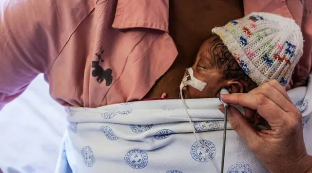 ప్రీమెచ్యూర్ బేబీ 