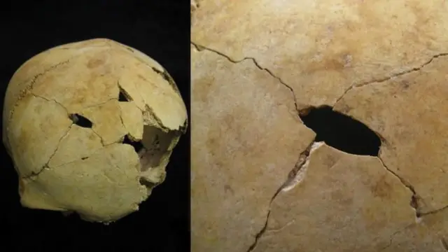 वैज्ञानिकांचं म्हणणं आहे की हिंसक हल्ले करण्यासाठी दगडी हत्यार किंवा साधनांचा वापर केला जात होता