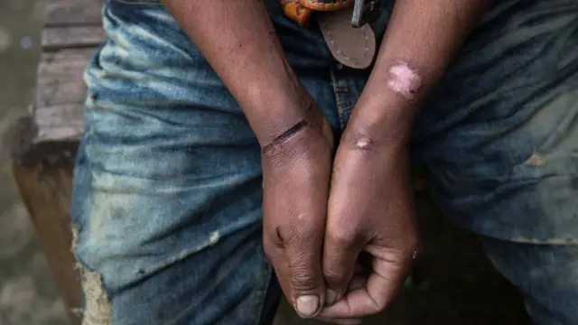 Un hombre con heridas