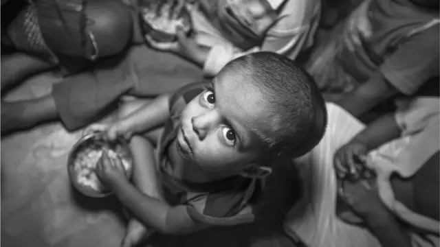 બાળકોમાં કુપોષણની ગંભીર સમસ્યા (પ્રતીકાત્મક તસવીર)