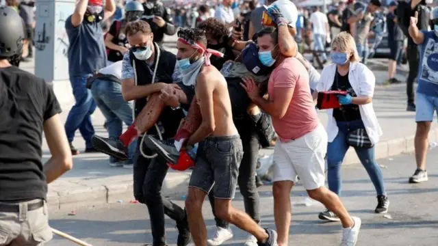 یکی از معترضان مجروح شده