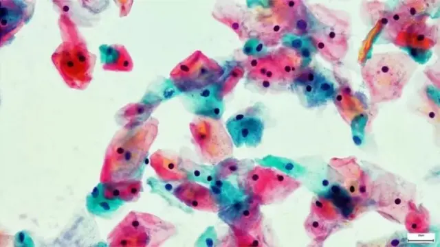 పాప్ స్మియర్ టెస్ట్