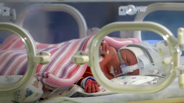Un bebé en una incubadora