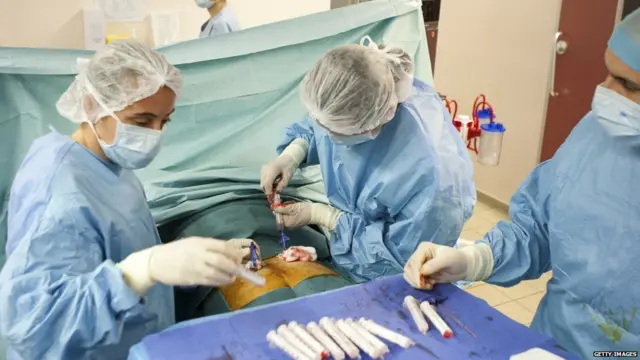 ਹਿੱਪ ਰਿਪਲੇਸਮੈਂਟ