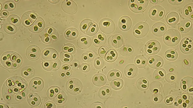 ਸਾਇਨੋਬੈਕਟੀਰੀਆ