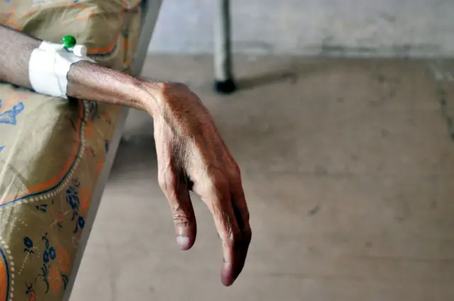 क्षयरोग