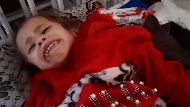 تدهور أوضاع الأطفال في مستشفيات غزة