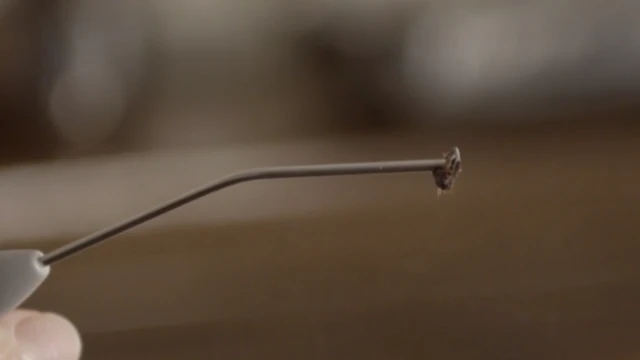 Tapón de cera extraído por un médico.