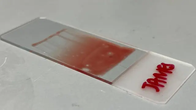 Una foto del portaobjeto donde está parte de la muestra de sangre extraída del periodista de la BBC.