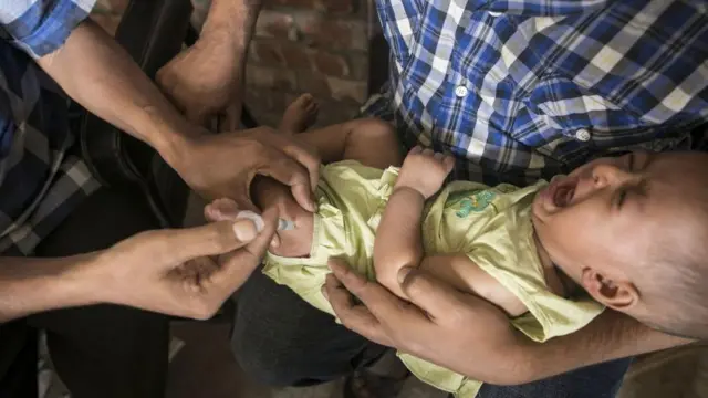 বাংলাদেশে ৯-১৫ মাস বয়সী শিশুদের দুই দফায় হামের টিকা দেওয়া হয়। তারপরেও অনেকে এই কর্মসূচির বাইরে থেকে যায় বলে আলোচনা আছে। 