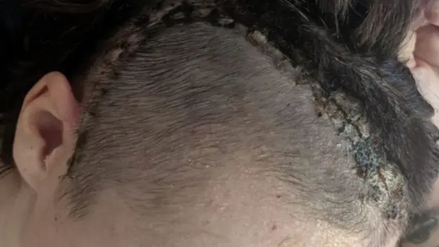 Christel ayaa laga gooyay burada inteedii badnayd