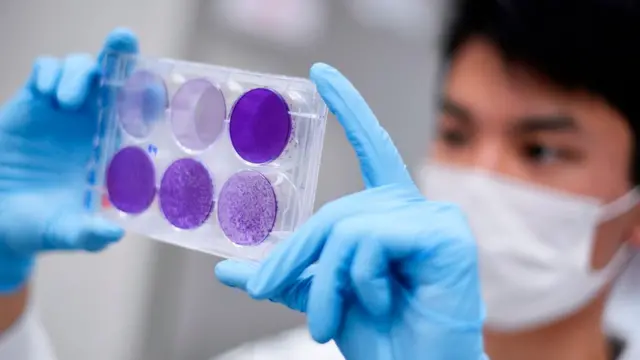 இரண்டாவது முறையாக கொரோனா தொற்று