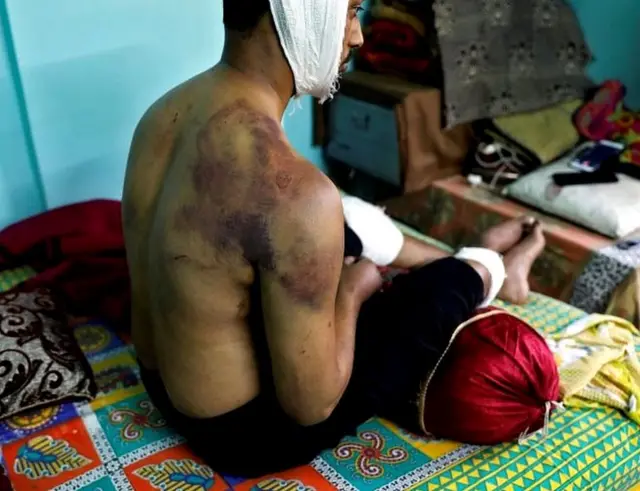 હિંસાનો ભોગ બનેલા યુવકની તસવીર