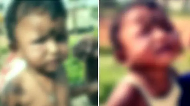 బాలికకు ఎలా గాయాలయ్యాయన్న దానిపై తల్లి ఇచ్చిన వివరణ మారింది