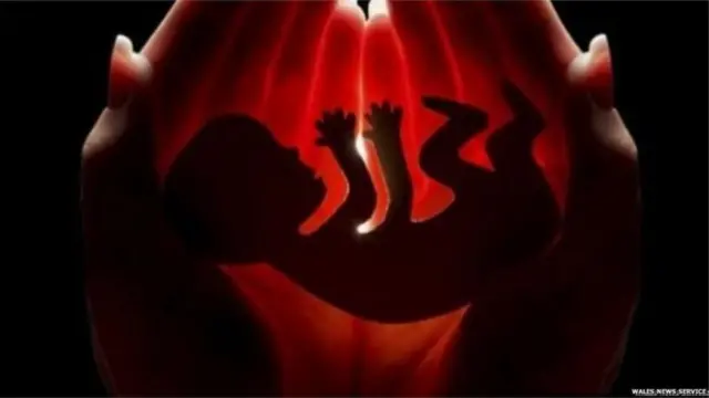 మిస్ కారేజ్