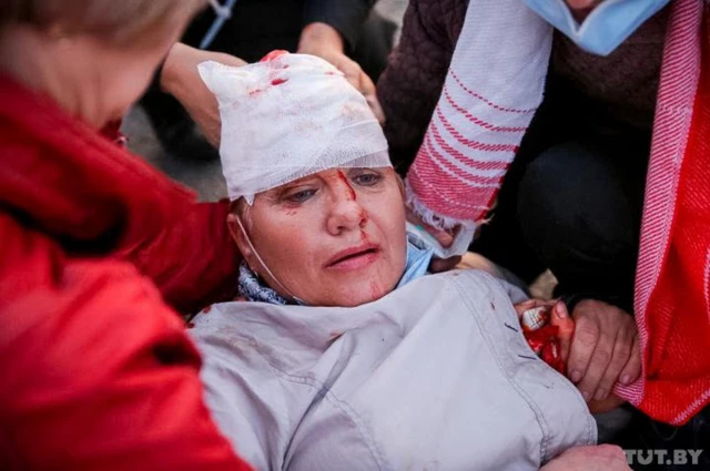 Женщина с перемотанной головой