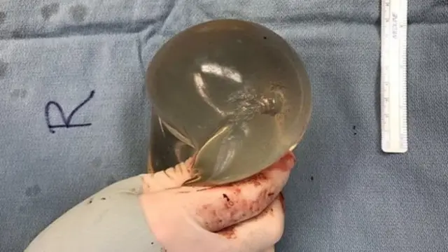 Musulmon ayol bilan jinsiy aloqa