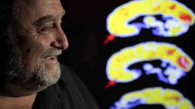 ਪ੍ਰੋਫ਼ੈਸਰ ਜਿਮ ਫਾਲੋਨ