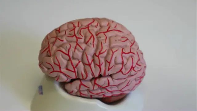 رغم كل التقدم العلمي والتكنولوجي، لم يتمكن الباحثون بعد من إيجاد علاج للخرف