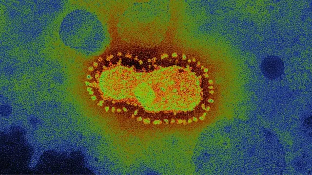 కరోనా వైరస్