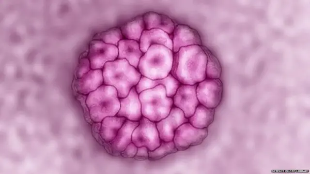 Human Papilloma Virus (HPV)मुळे कॅन्सर होऊ शकतो.