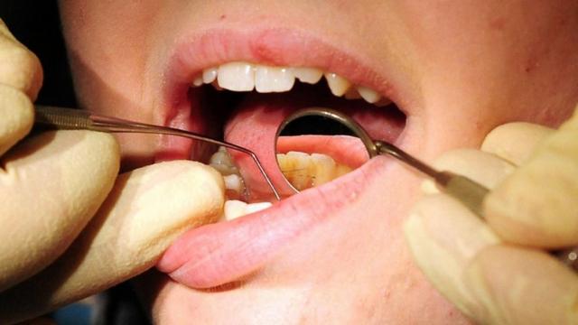 如果不注意，牙周炎會導致牙齒脫落，同時也會帶來健康風險。