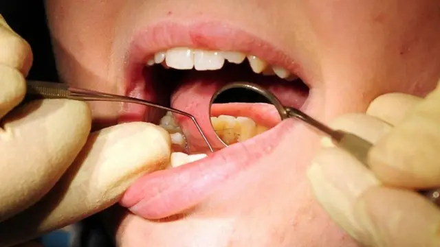 如果不注意,牙周炎會導致牙齒脫落,同時也會帶來健康風險。