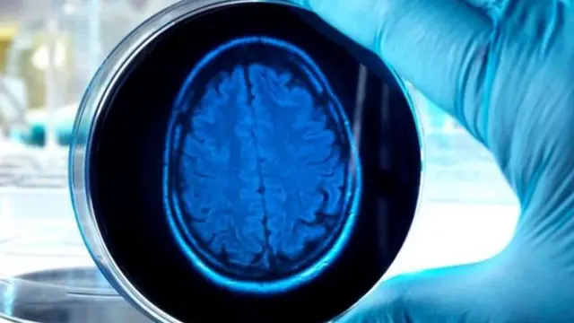 Маленький мозг